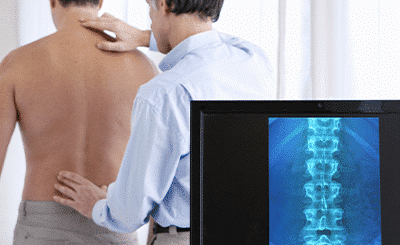 Stem Cells for Back Pain: Expectations vs. Reality
