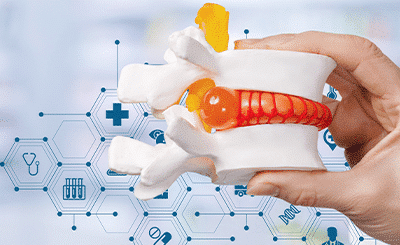 5 Common Misconceptions About Stem Cell Therapy for Herniated Discs