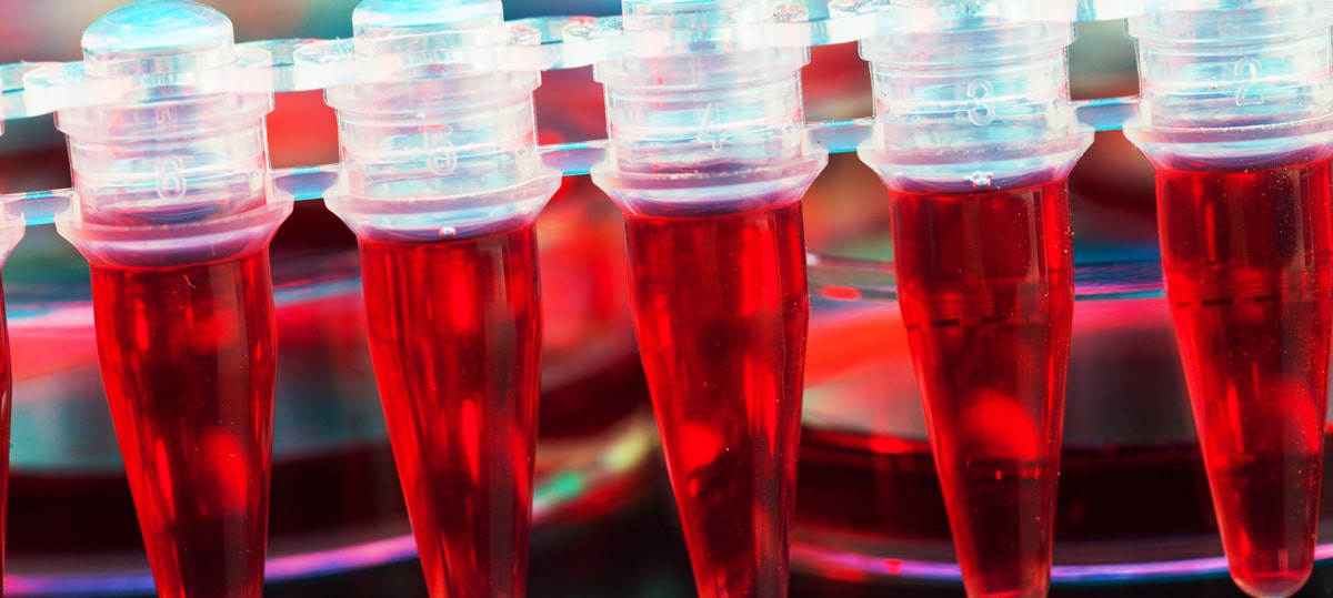 Row of transparent blood collection tubes filled with red liquid in a rack with blue caps in a clinic setting