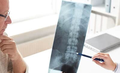 Stem Cell Therapy For Back Pain vs. Back Surgery Explained