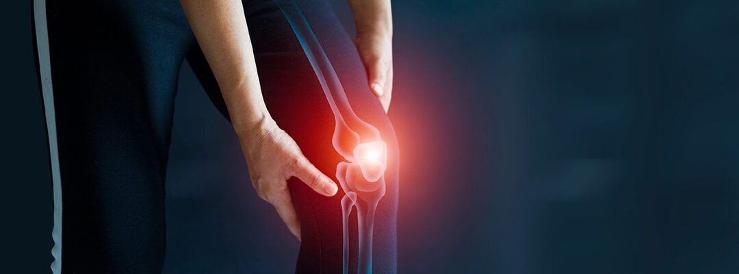 Regenerative Therapy for Knees: What It Is, the Process and Recovery