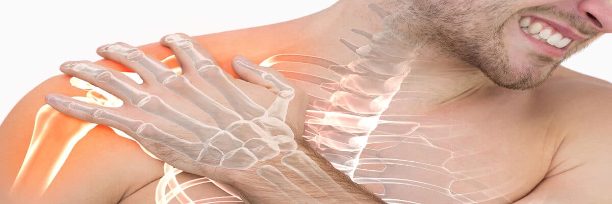 Smiling man clutching his shoulder with an overlaid skeletal diagram highlighting the shoulder joint and neck region to indicate musculoskeletal pain.