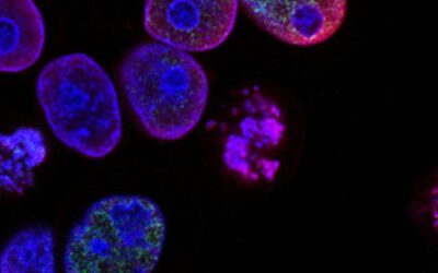Stem Cells: A Hip Pain Treatment without Surgery
