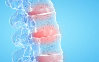 New Spinal Disc Treatments