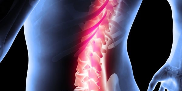 Computer-generated image of a back with spine highlighted to show pain